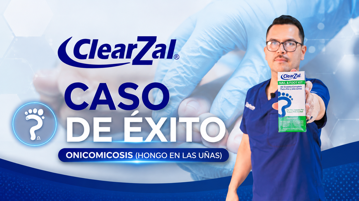 Cargar video: 